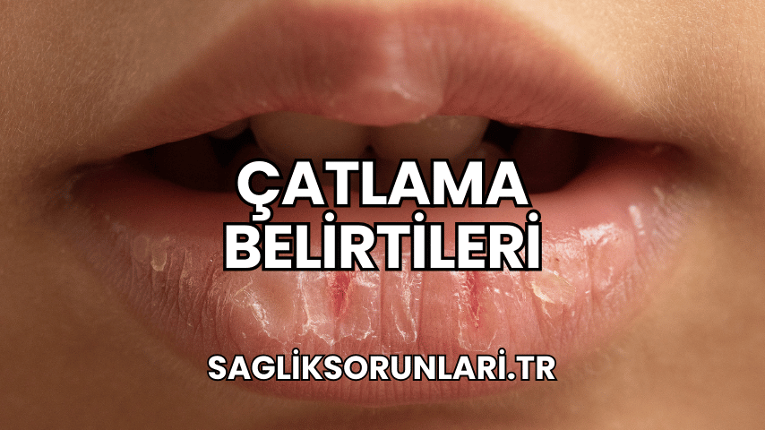 Çatlama Belirtileri