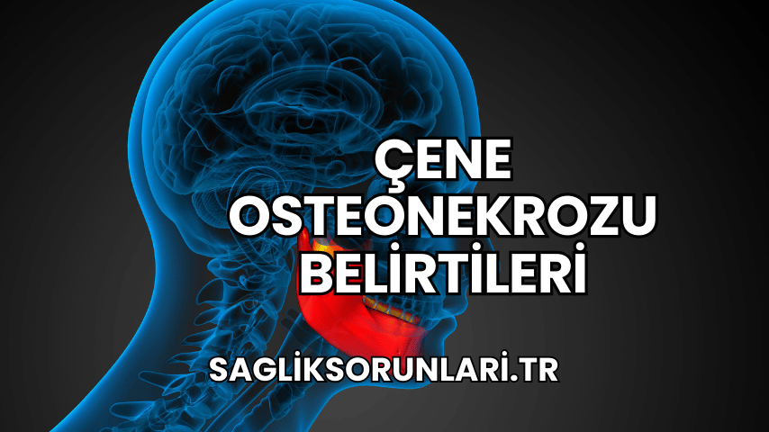 Çene Osteonekrozu Belirtileri