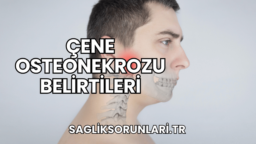 Çene Osteonekrozu Belirtileri