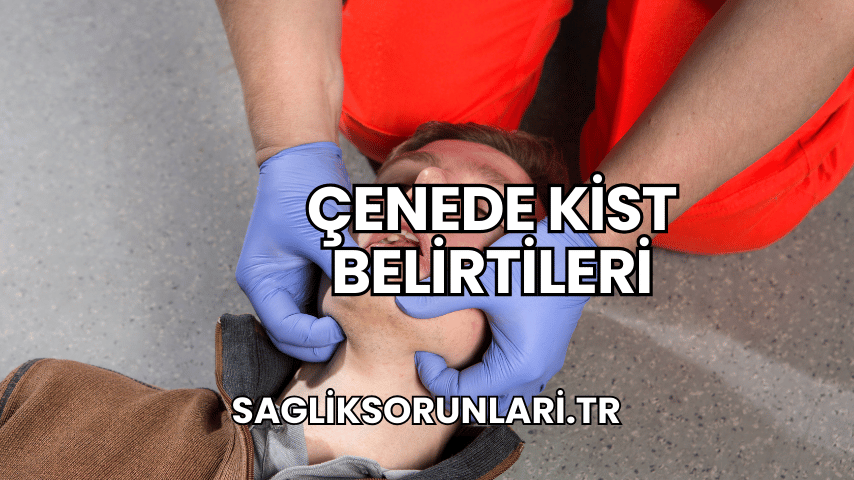 Çenede kist belirtileri