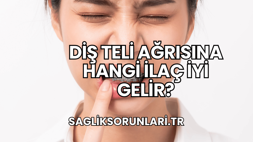 Diş Teli Ağrısına Hangi İlaç İyi Gelir?