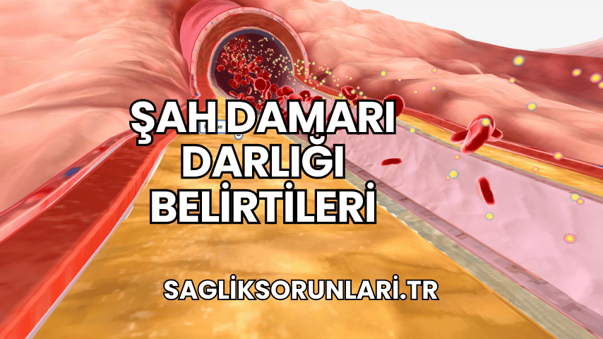 Şah Damarı Darlığı Belirtileri