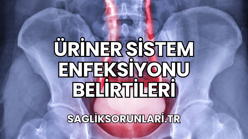 Üriner Sistem Enfeksiyonu Belirtileri