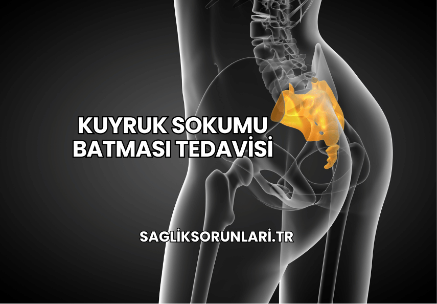 Kuyruk Sokumu Batması Tedavisi